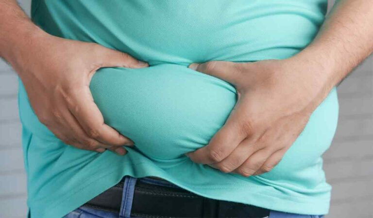 Obesity 1